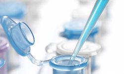 Разработан новый тест для раннего определения рака полости рта